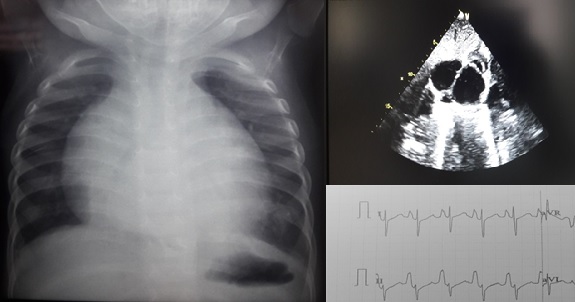 Imagenes de radiografia del caso clinico